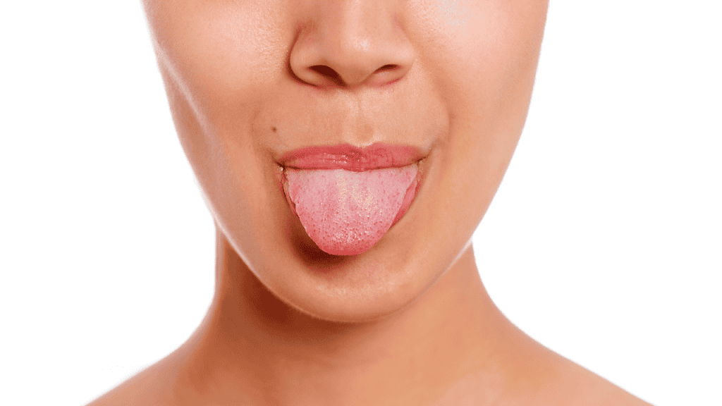 Scalloped Tongue
