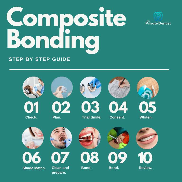 how much does composite bonding cost?