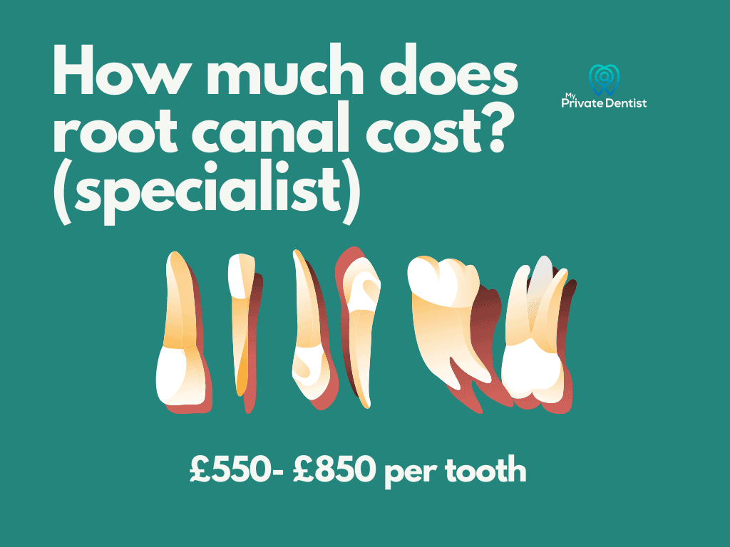 root canal cost