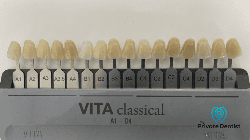 Teeth Whitening cost in the UK
