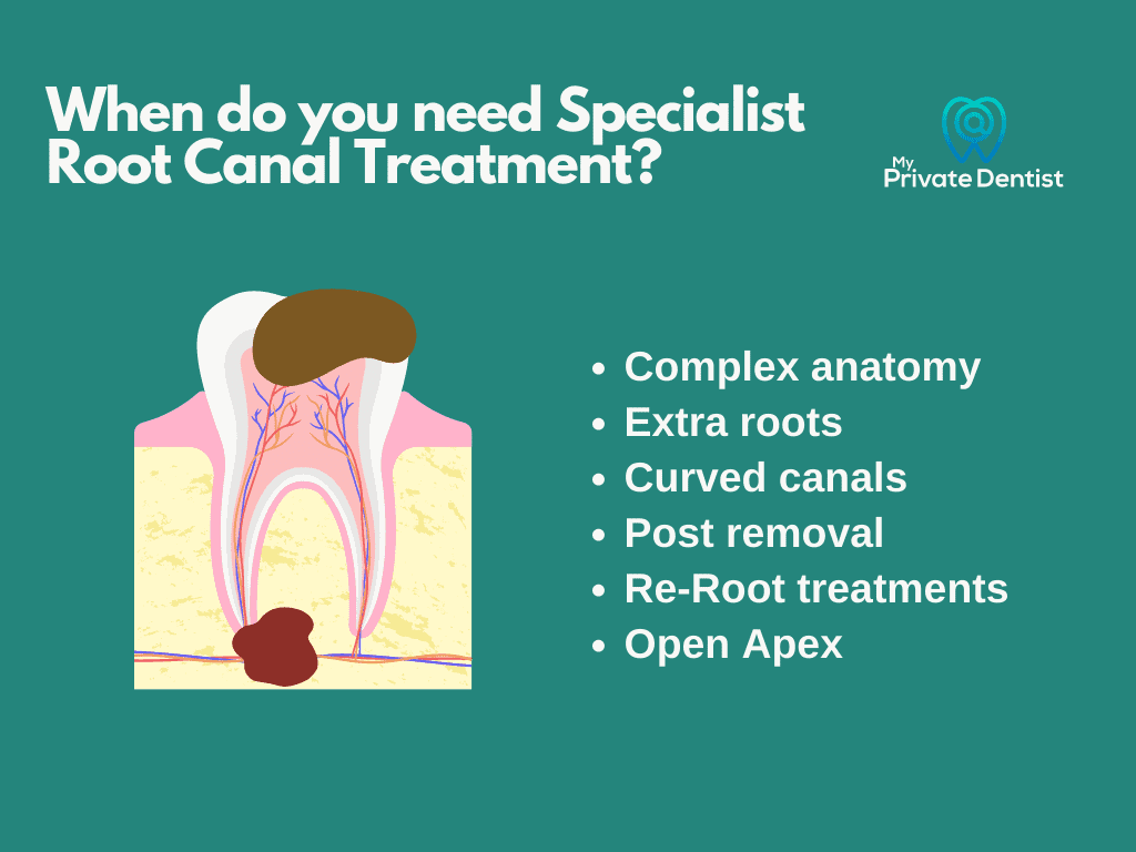 Root canal specialist