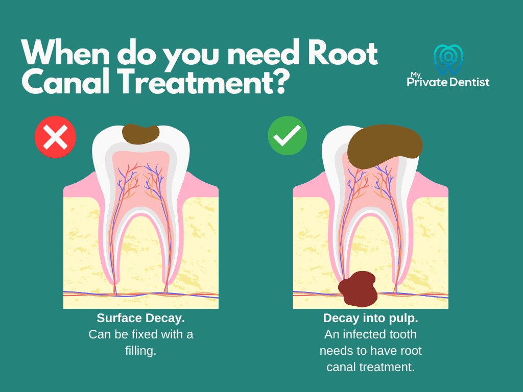 Root canal specialist