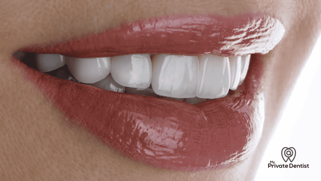 Dental Crowns Vs Veneers
