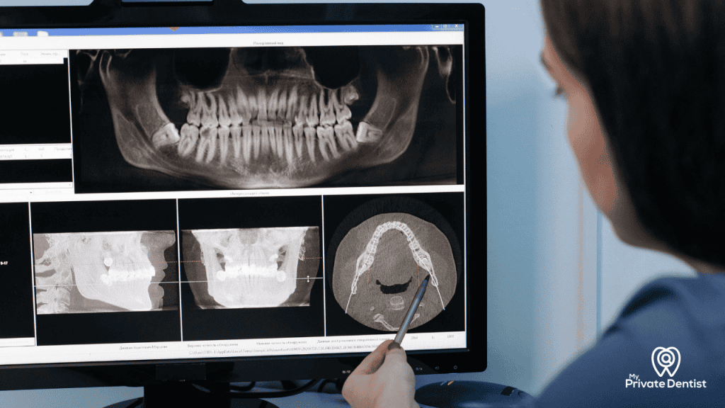 Choose a private dentist