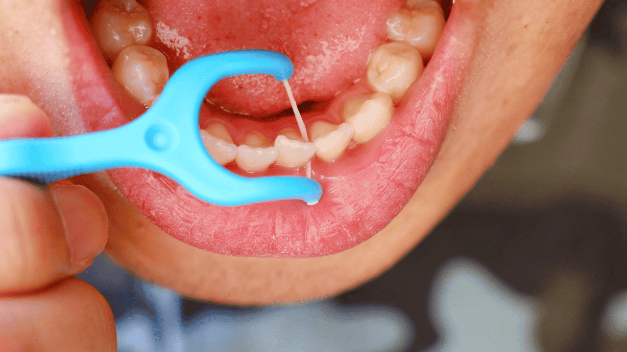 How To Floss Your Teeth: 7 Simple Steps To Flossing Properly
