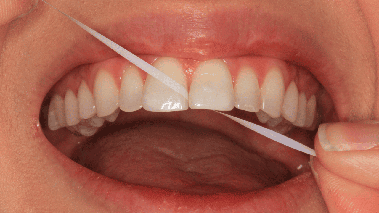 How To Floss Your Teeth: 7 Simple Steps To Flossing Properly