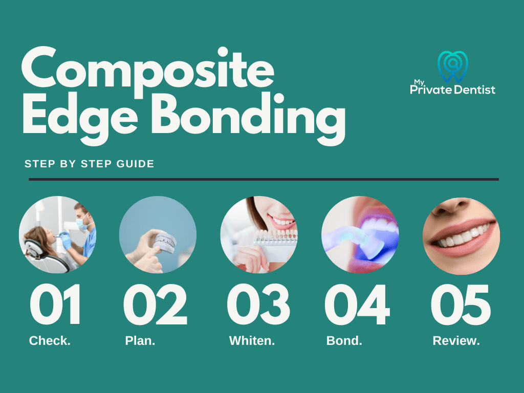 Composite Edge bonding