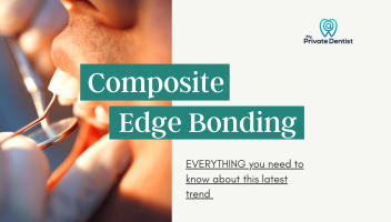 Composite Edge Bonding