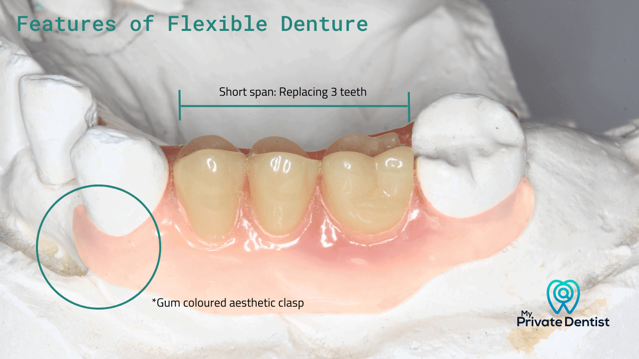 Features of a flexible denture