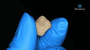 Temporary Crown Pain: Is It Normal?