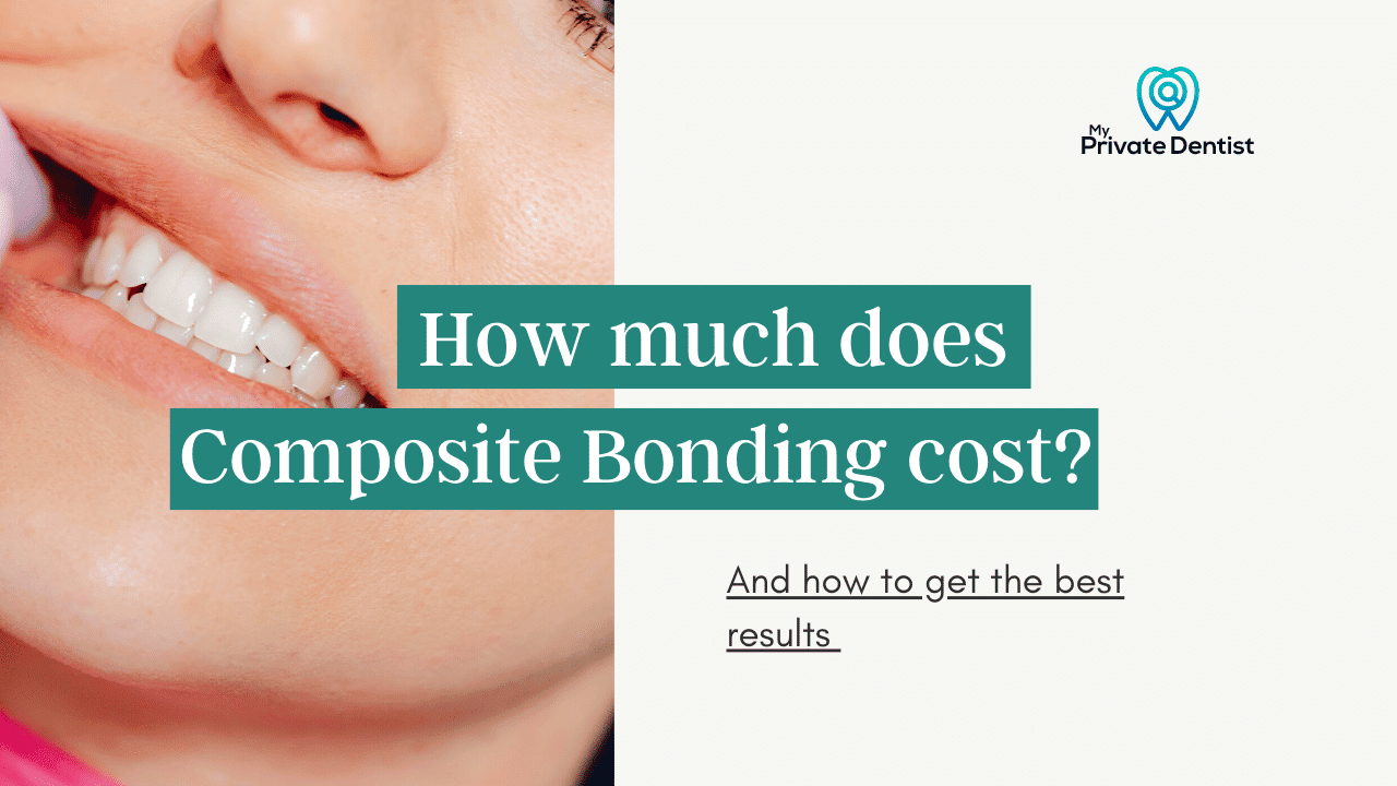 How Much Does Composite Bonding Cost how-much-does-composite-bonding-cost