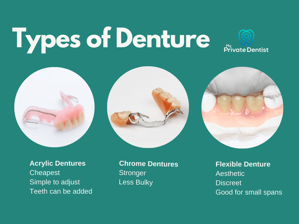 Tooth replacement: Types of denture