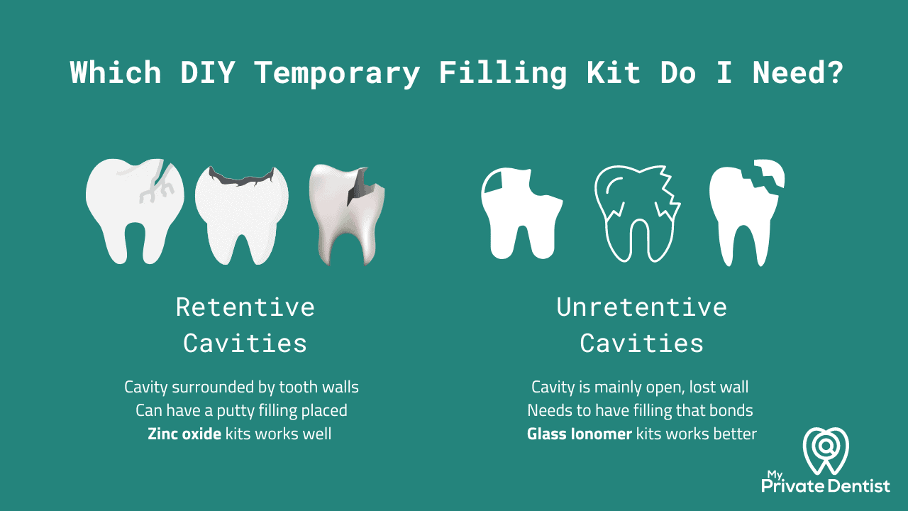 Best Overall Temporary Filling Kit