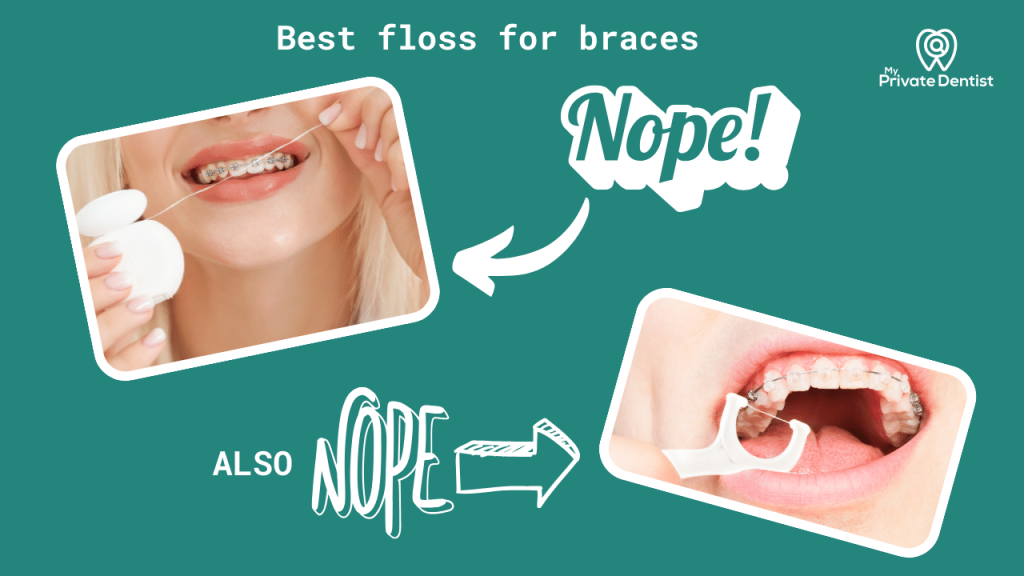Best floss for braces