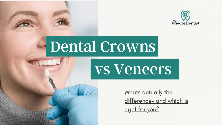 Dental crowns vs veneers
